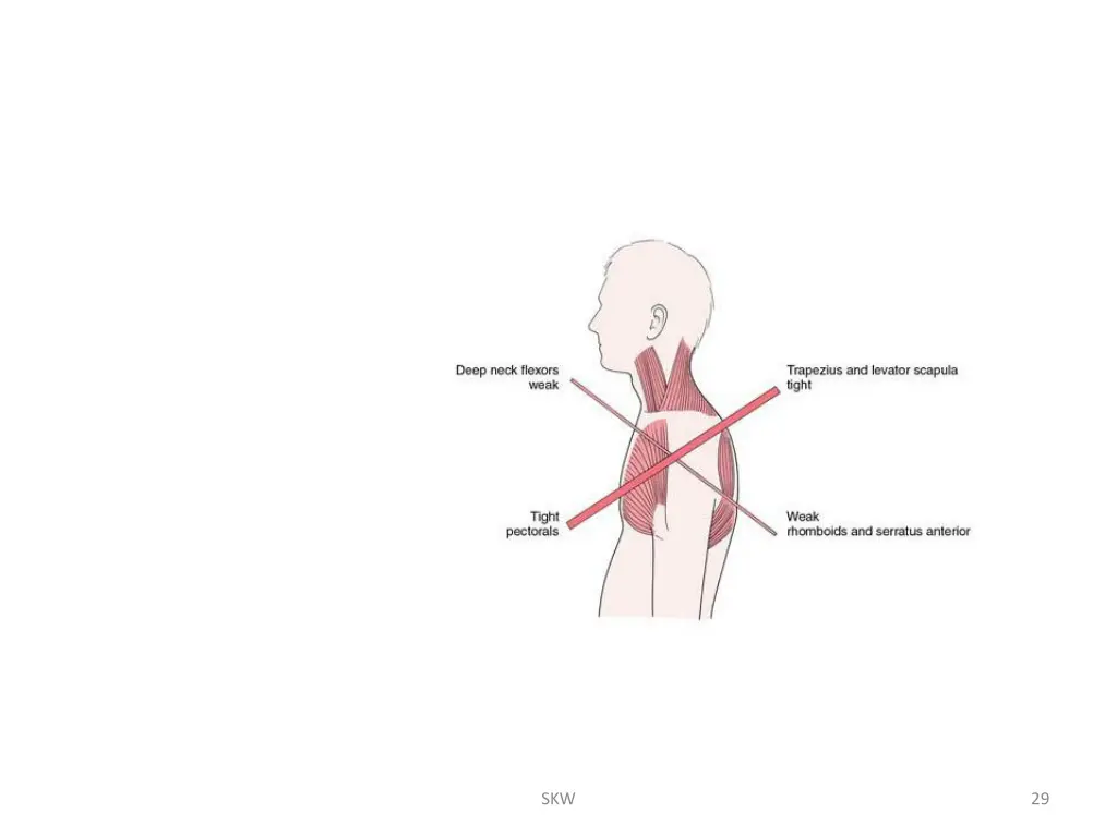 slide29