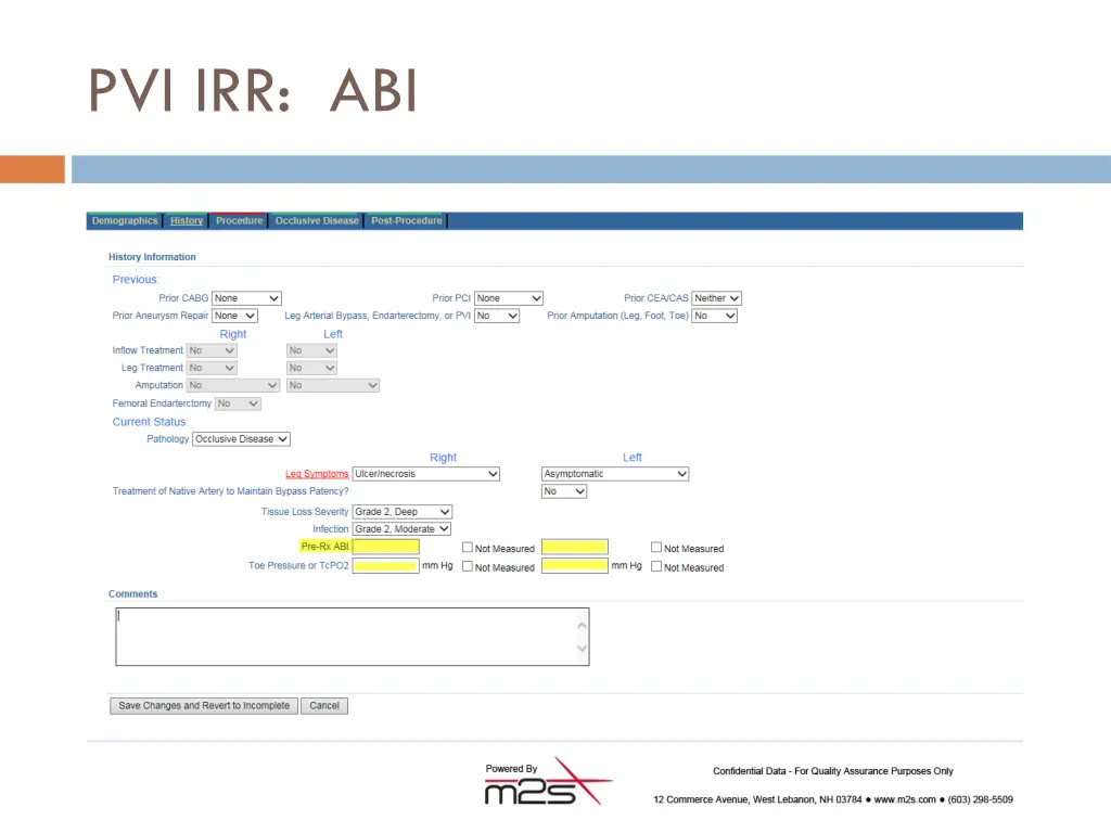 pvi irr abi