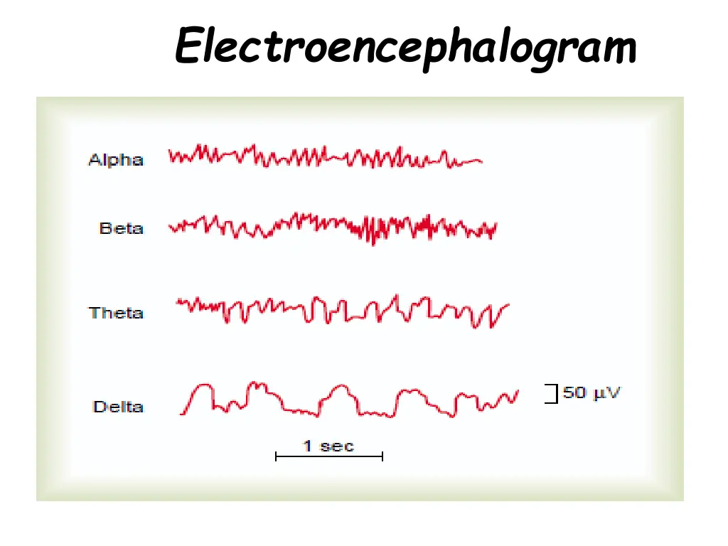 electroencephalogram