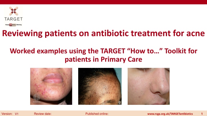 reviewing patients on antibiotic treatment