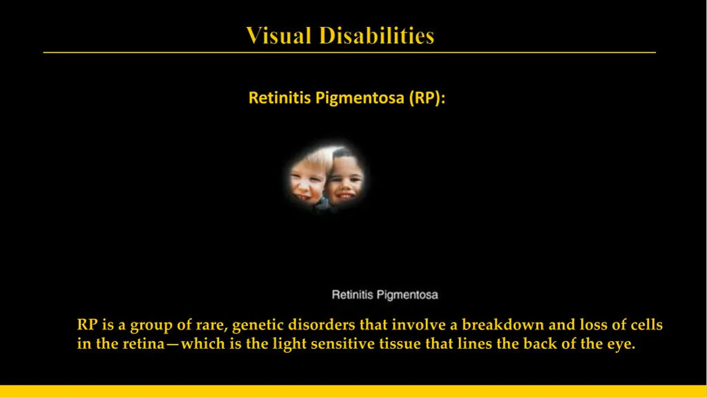 retinitis pigmentosa rp