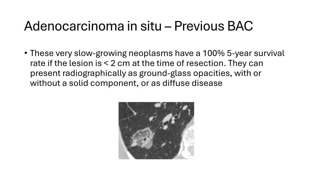 adenocarcinoma in situ previous bac