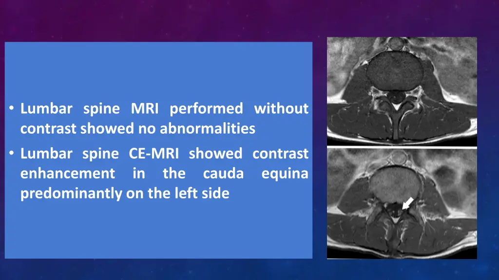 lumbar spine mri performed without contrast