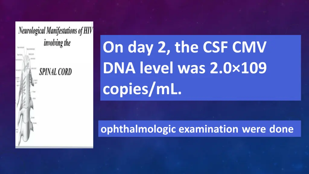 on day 2 the csf cmv dna level was 2 0 109 copies