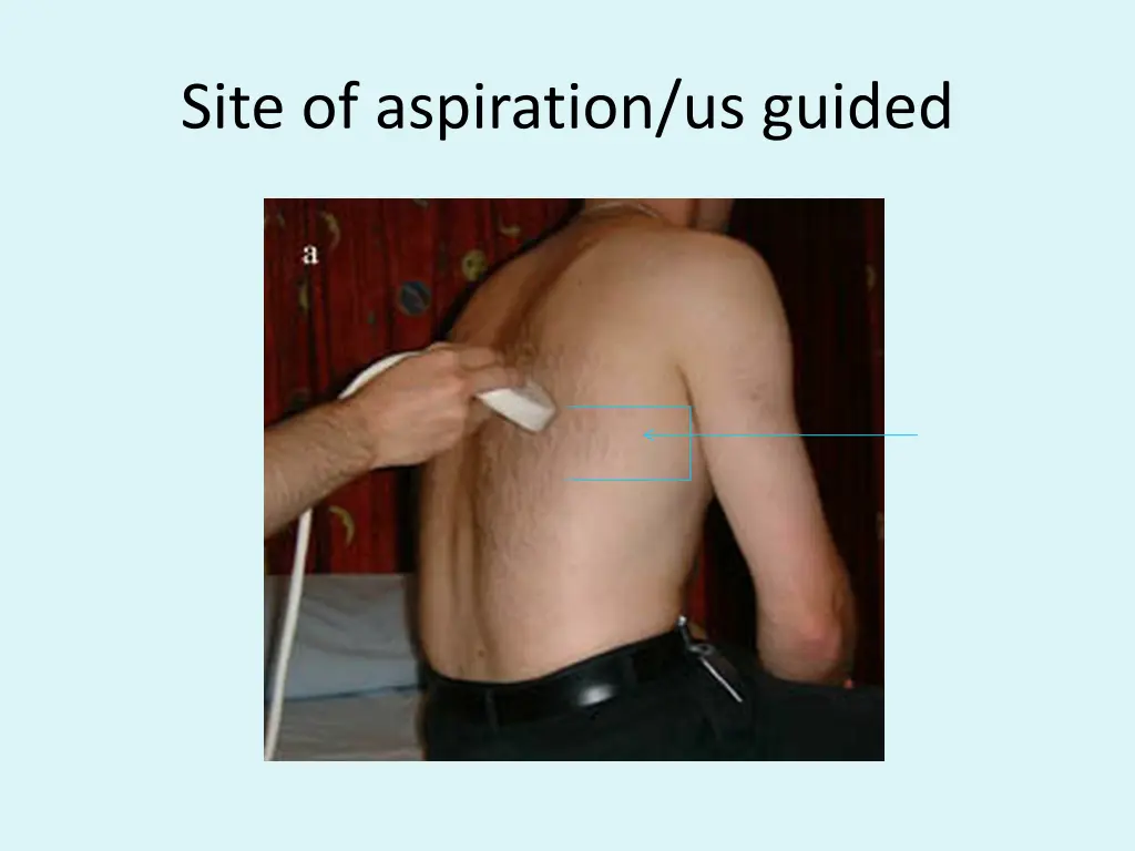 site of aspiration us guided
