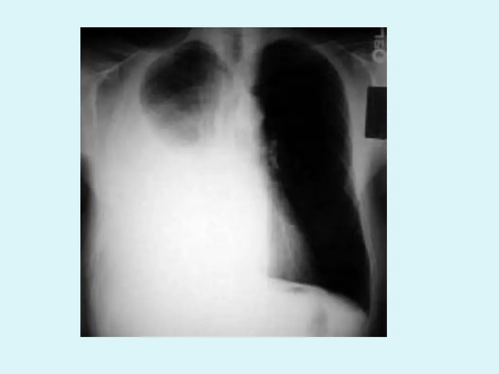 slide25