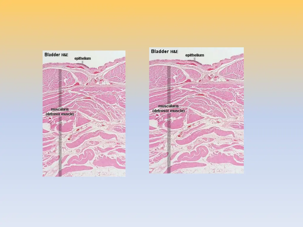 slide22