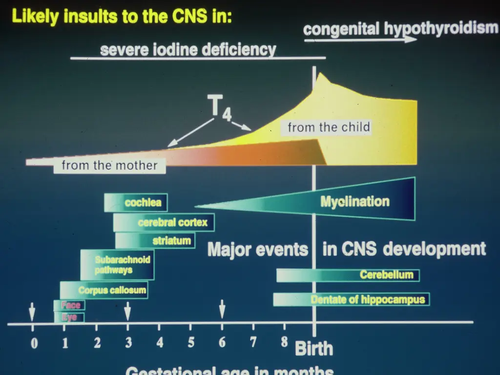 slide5