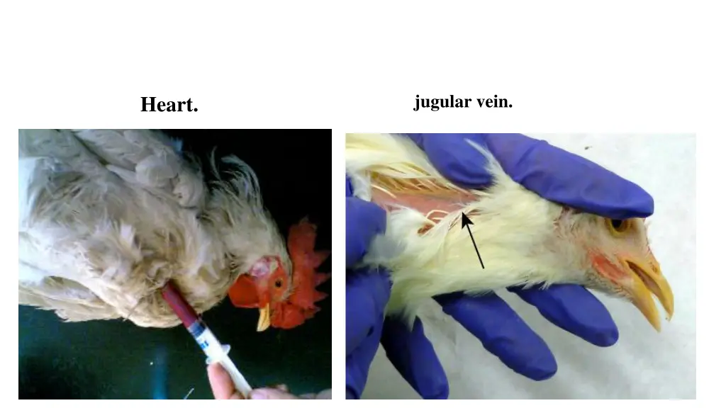 jugular vein