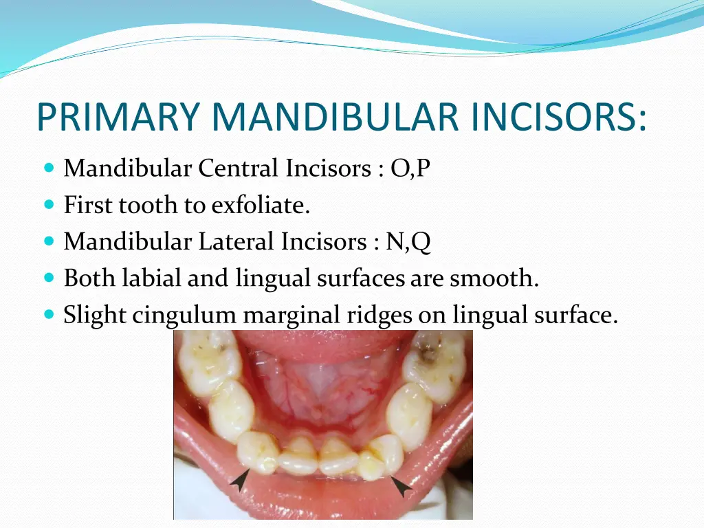 primary mandibular incisors