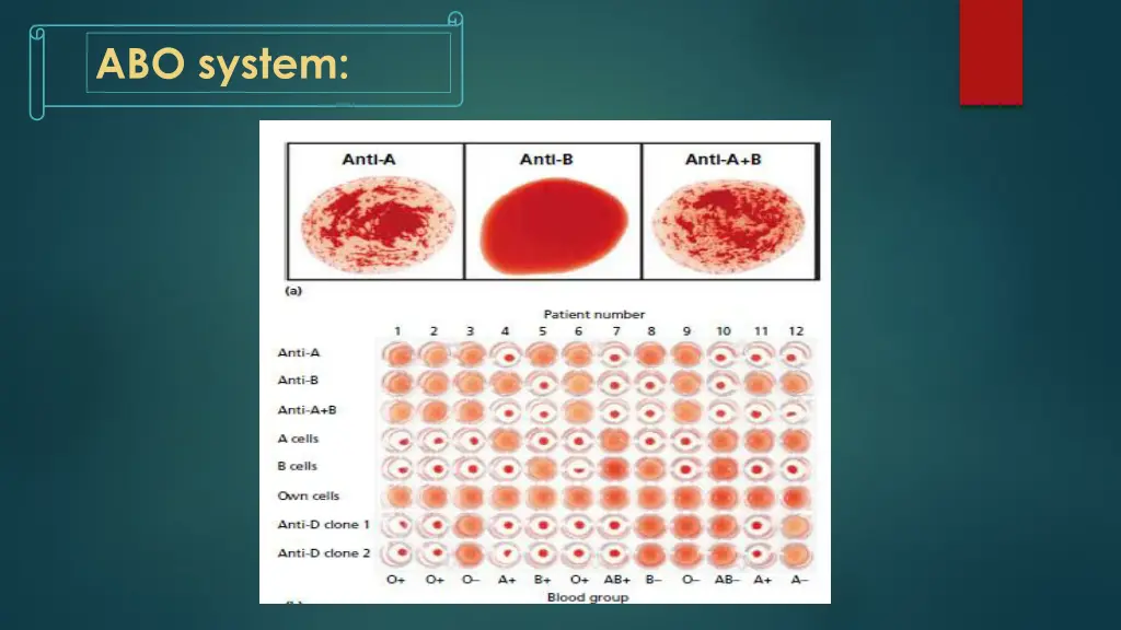 abo system