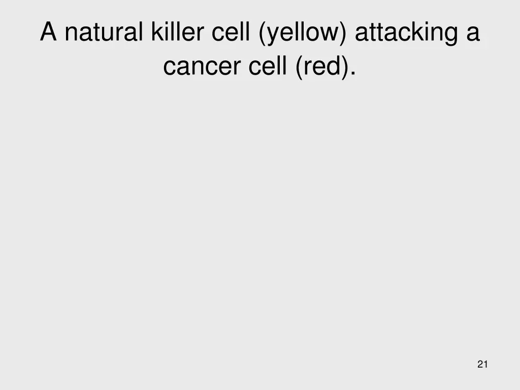a natural killer cell yellow attacking a cancer