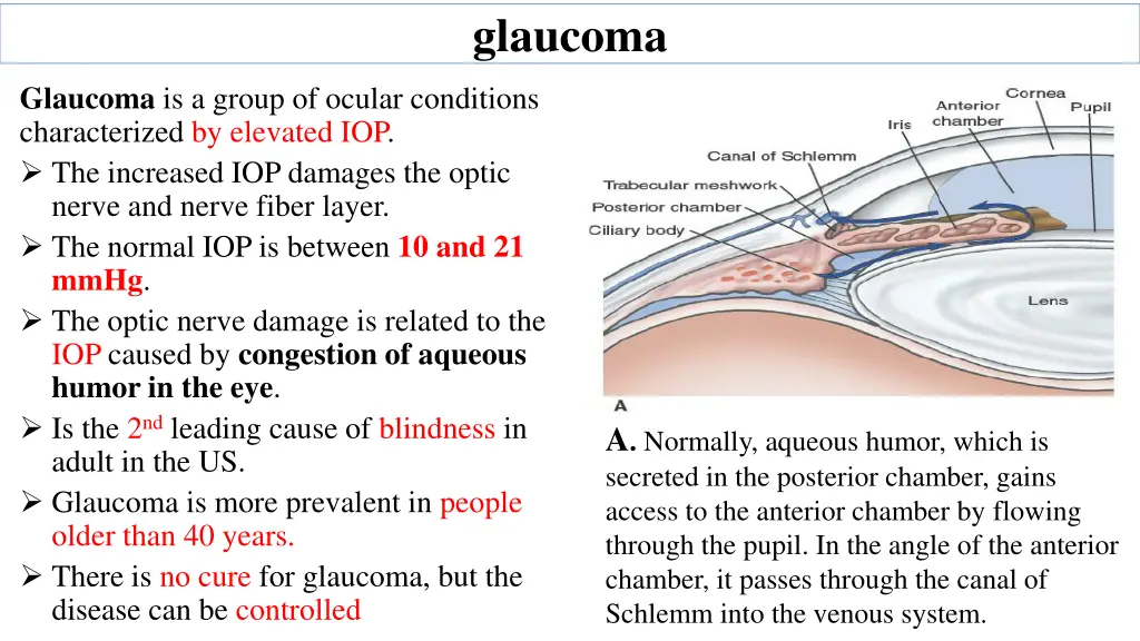 glaucoma