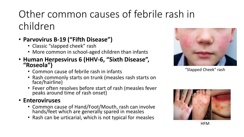 other common causes of febrile rash in children