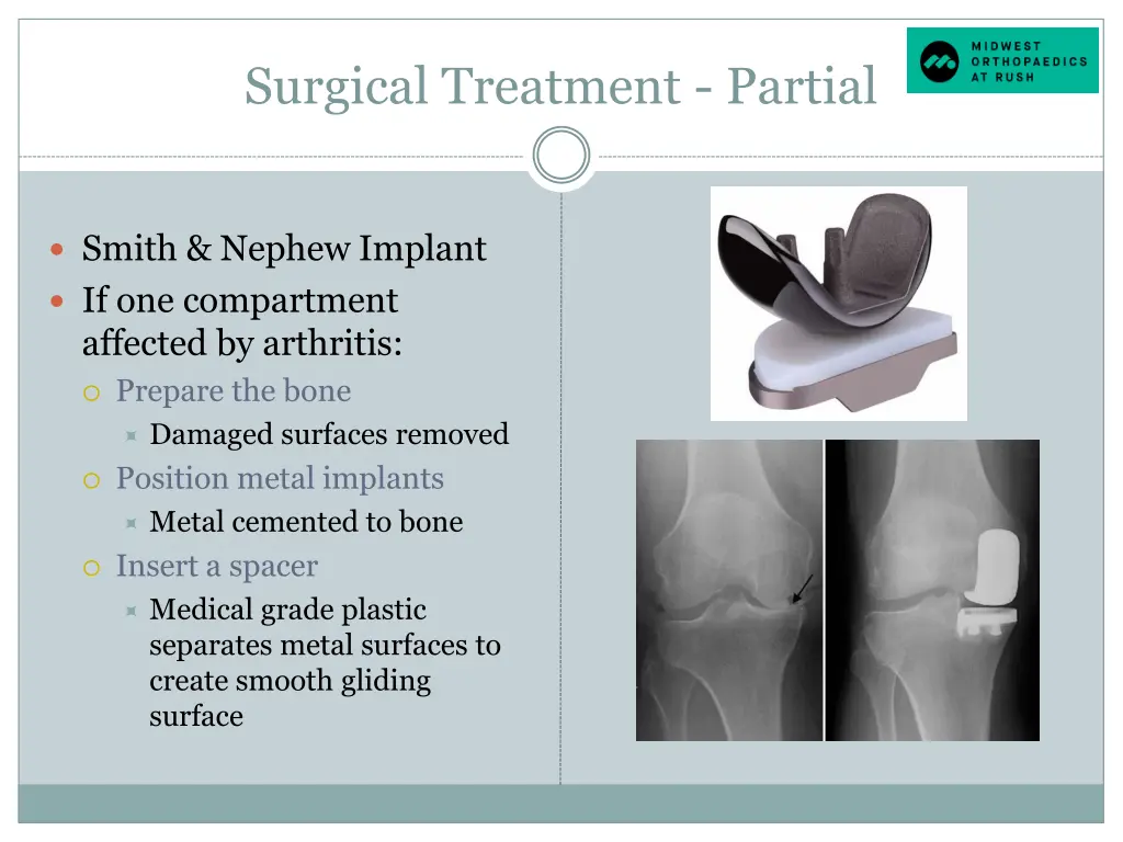 surgical treatment partial