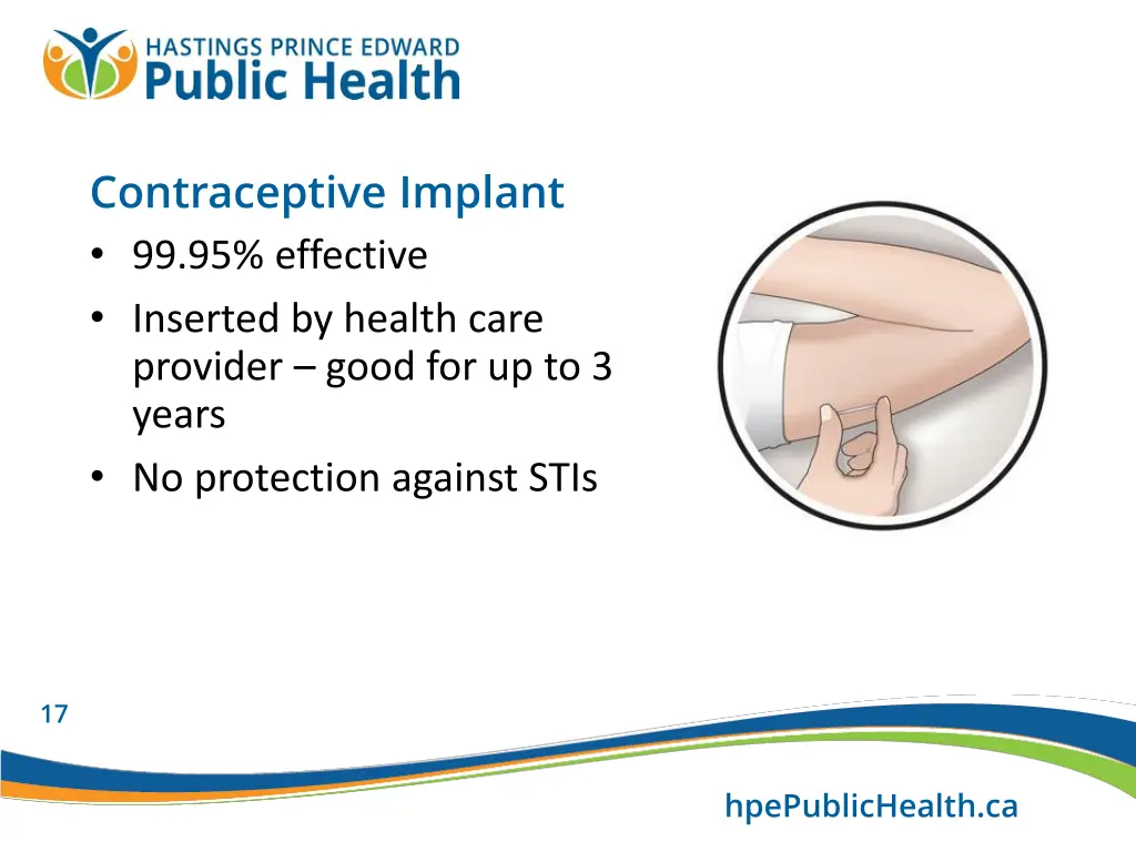 contraceptive implant