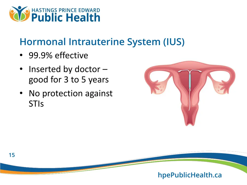 hormonal intrauterine system ius