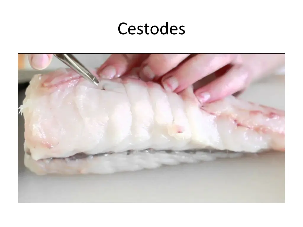 cestodes