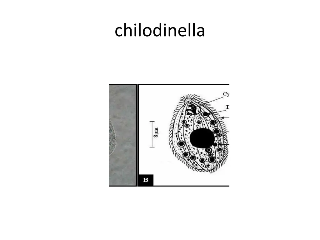 chilodinella