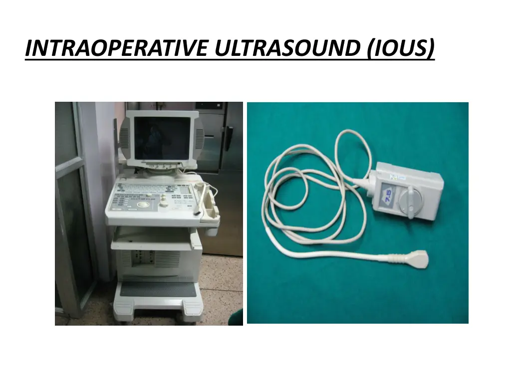 intraoperative ultrasound ious