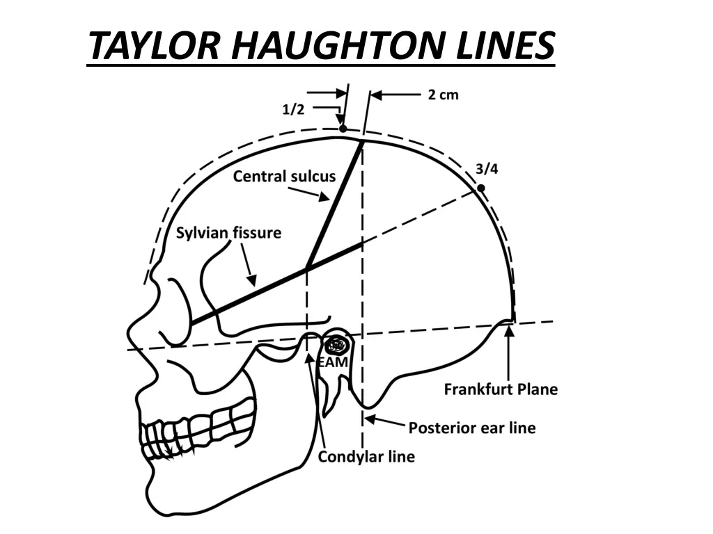 taylor haughton lines