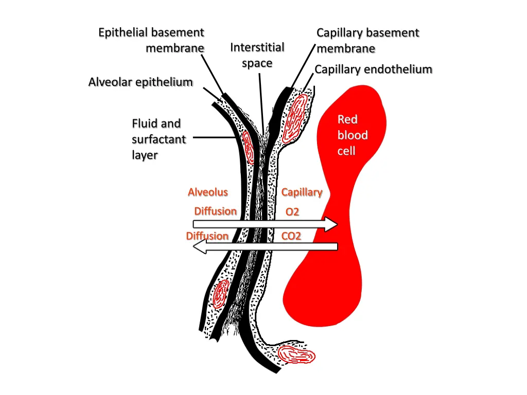 epithelial basement membrane