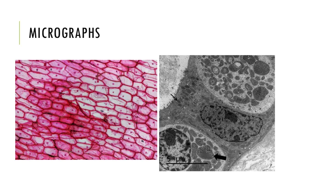 micrographs