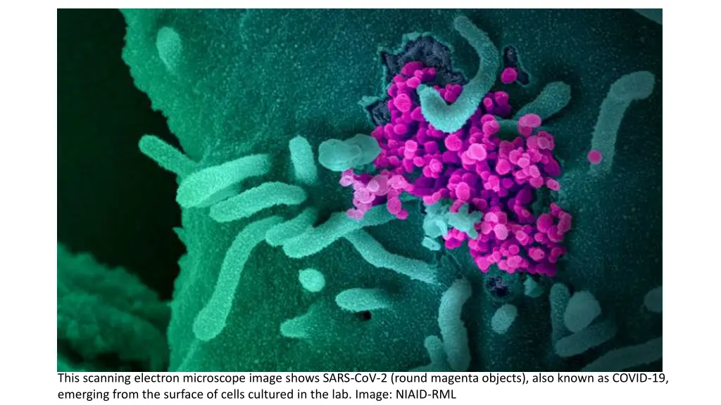 this scanning electron microscope image shows