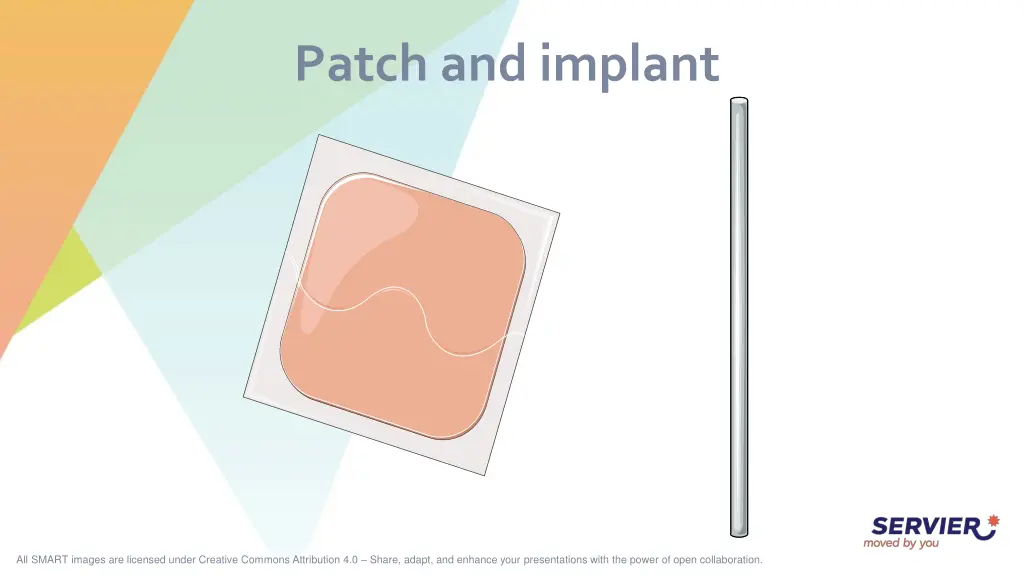 patch and implant
