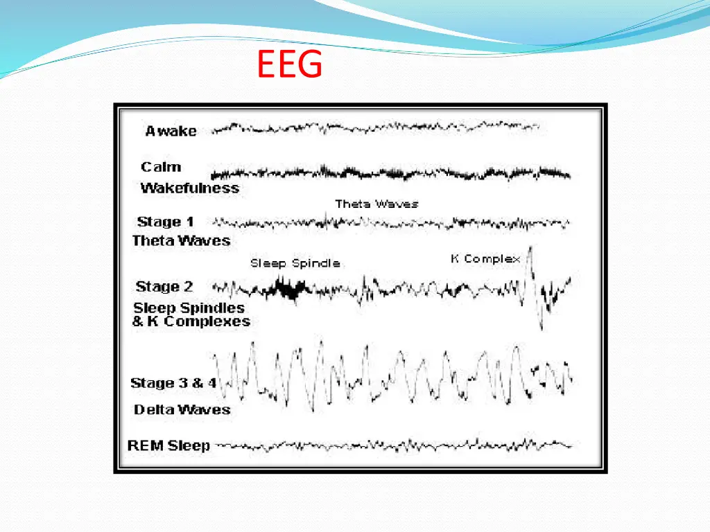 slide10