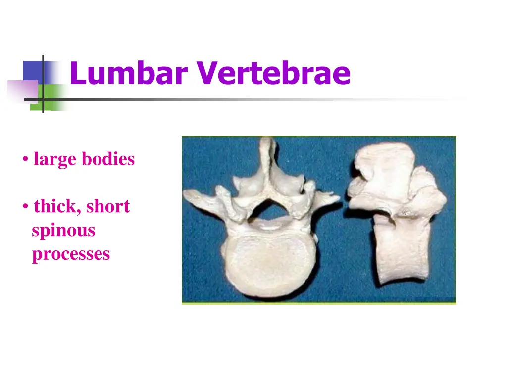 lumbar vertebrae