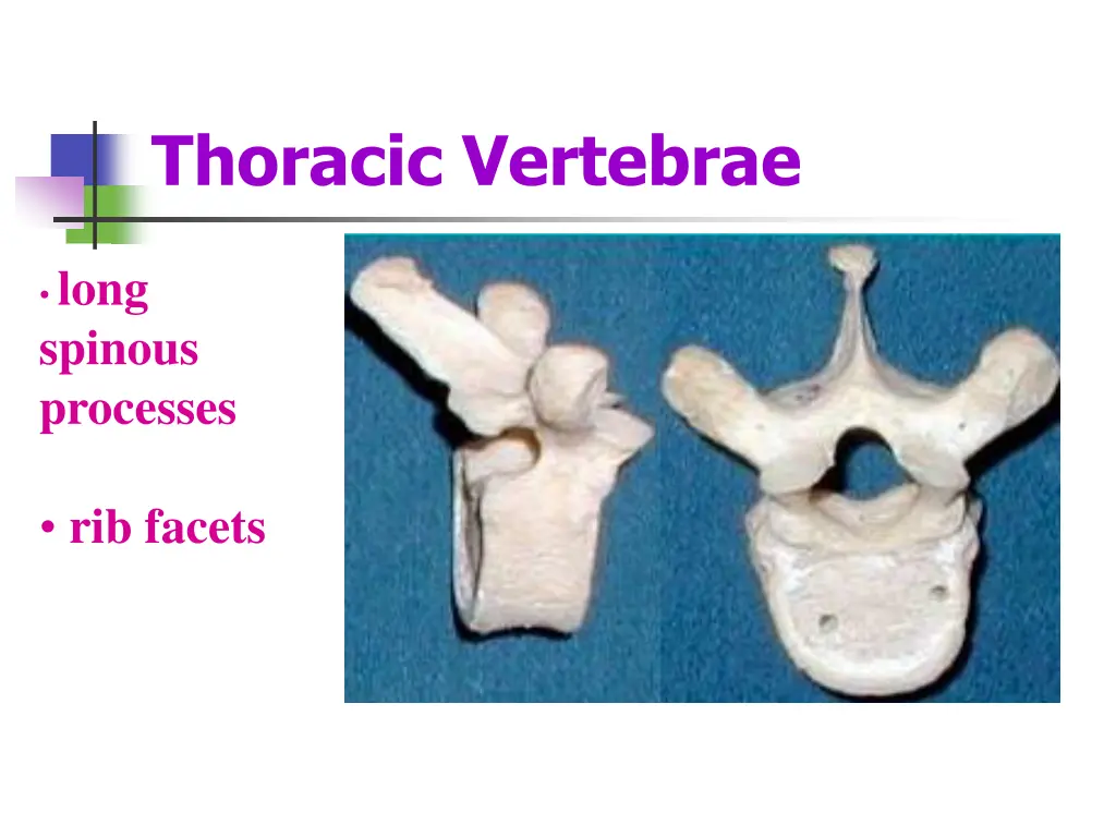 thoracic vertebrae