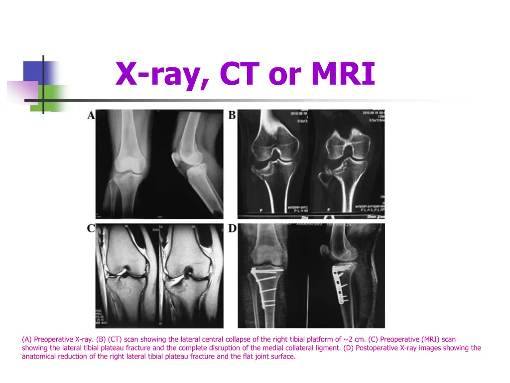 x ray ct or mri