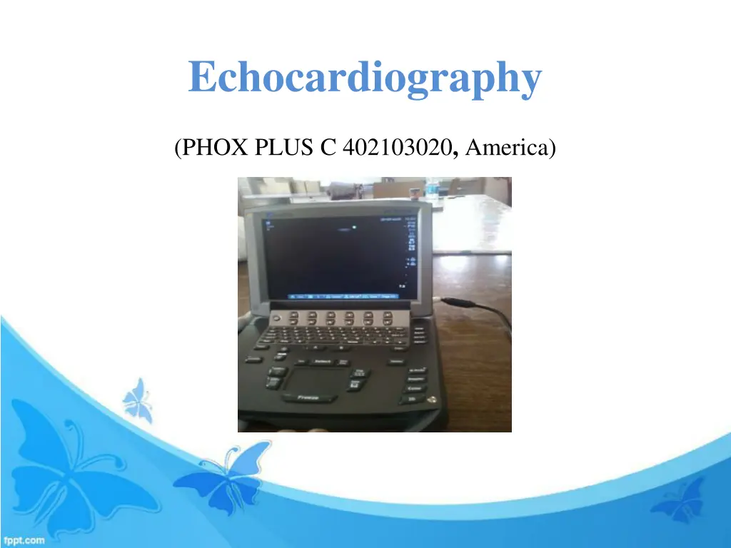 echocardiography