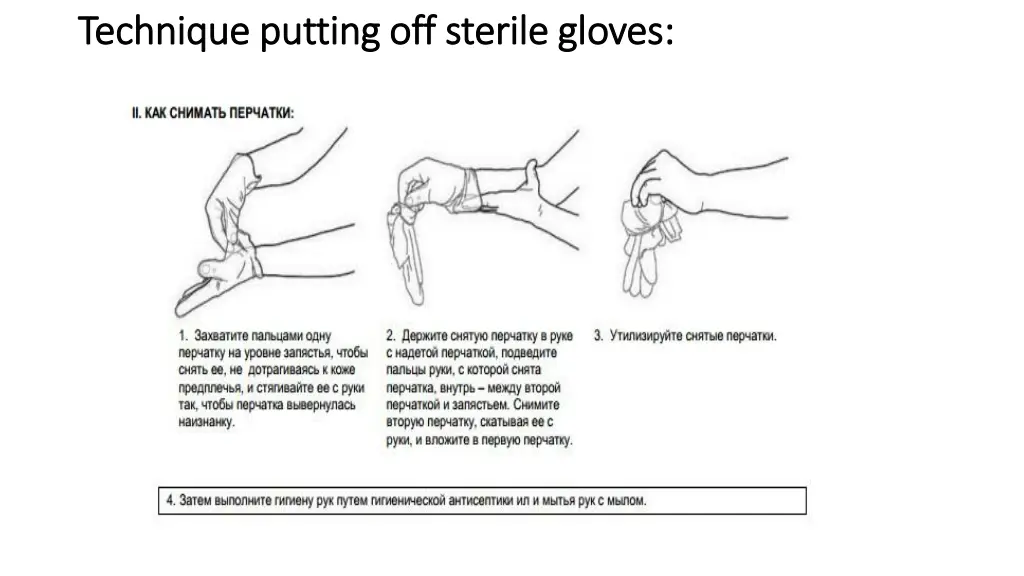 technique putting off sterile gloves technique