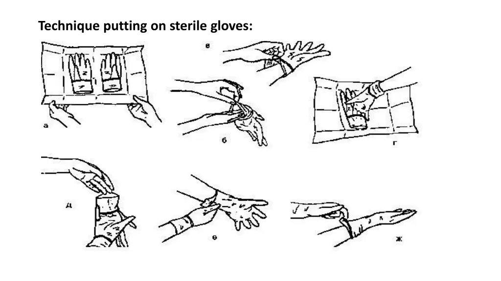 technique putting on sterile gloves