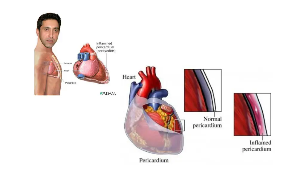 slide34