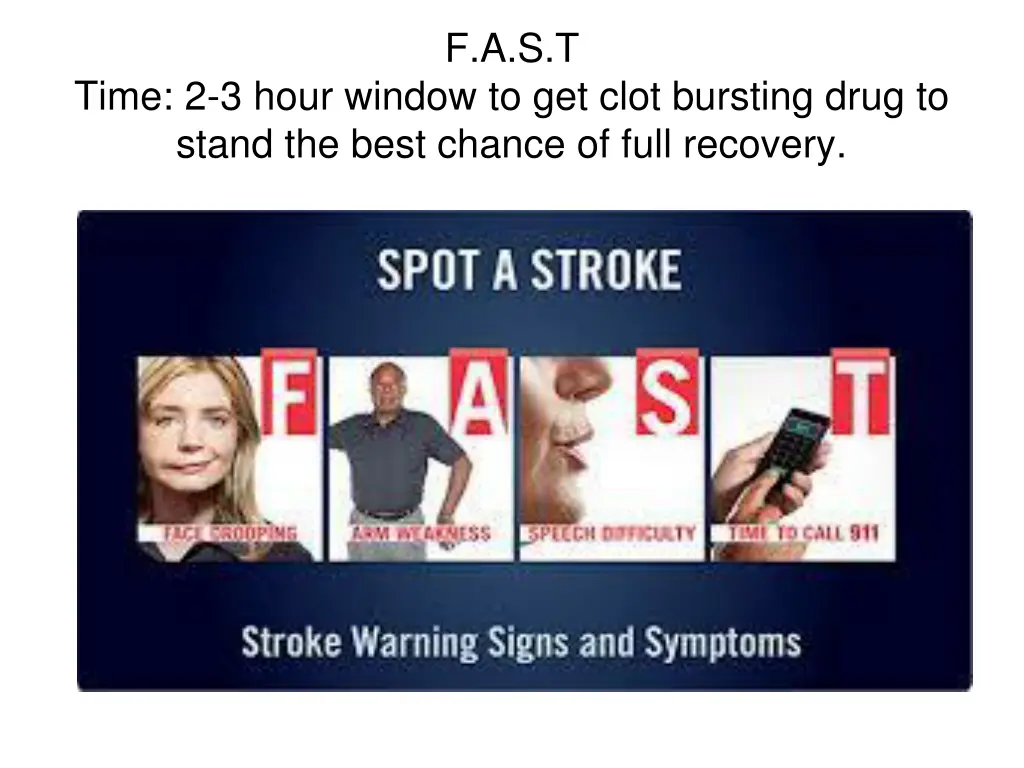 f a s t