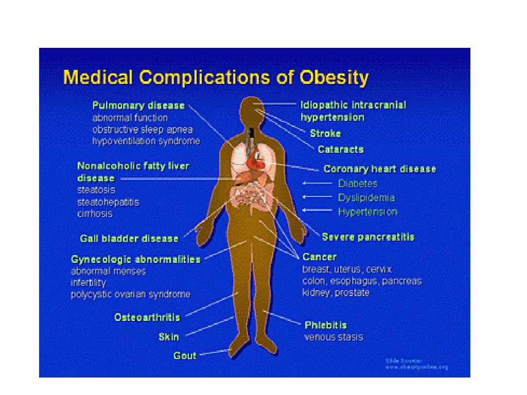 slide19