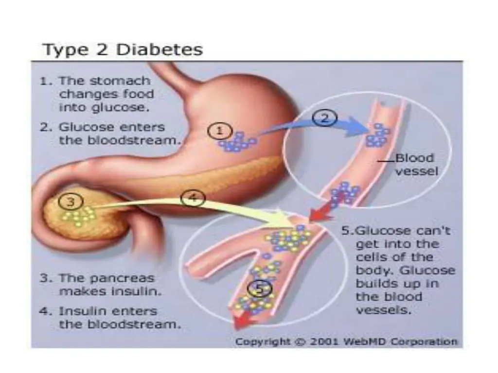 slide41