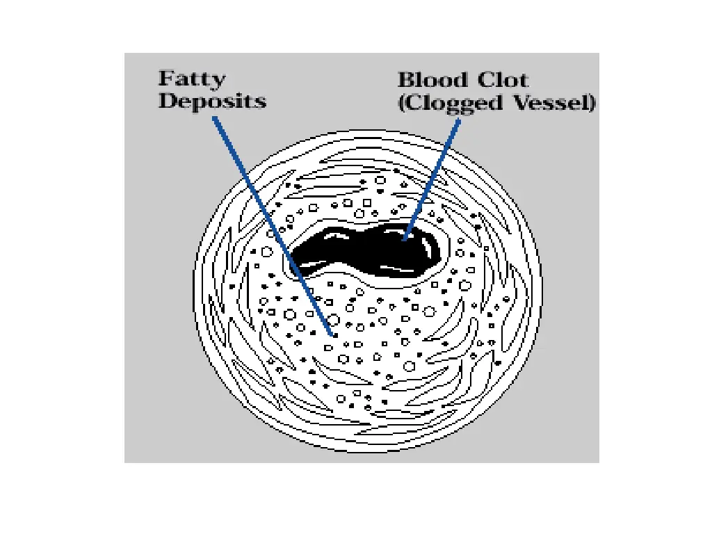 slide7
