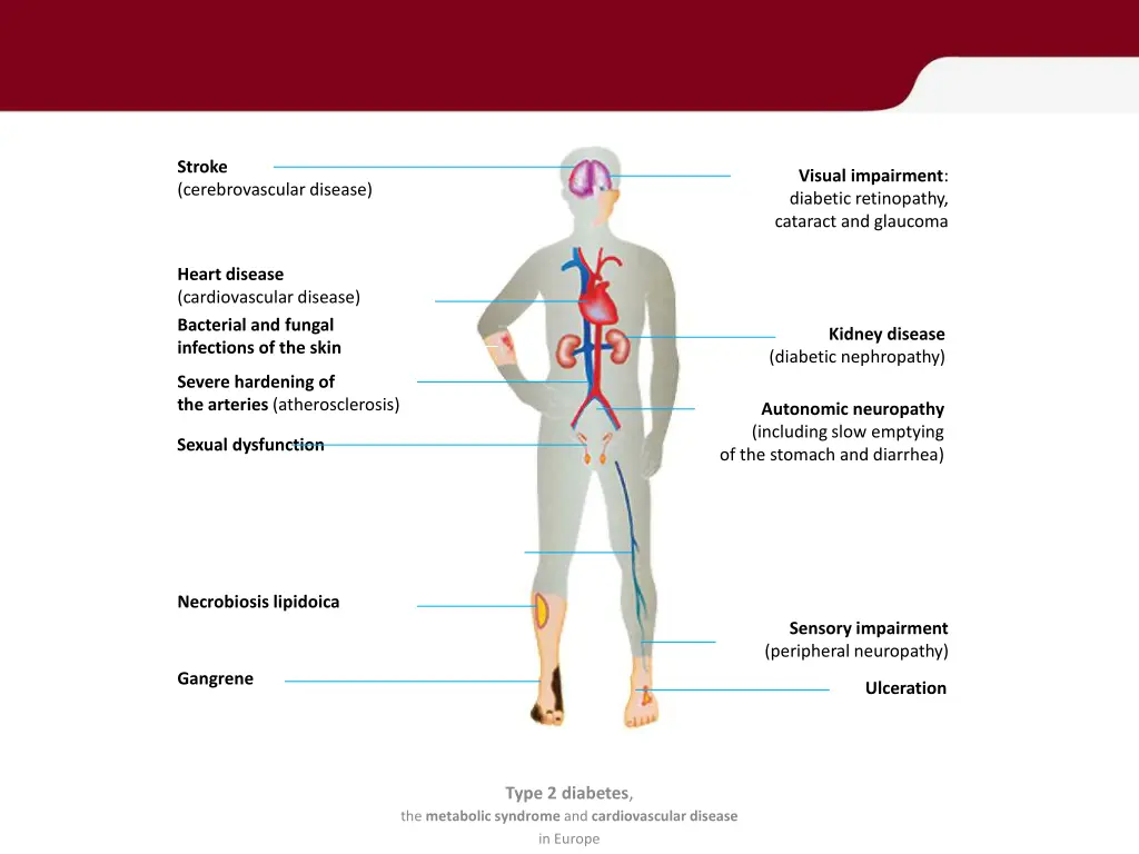 the major diabetic complications
