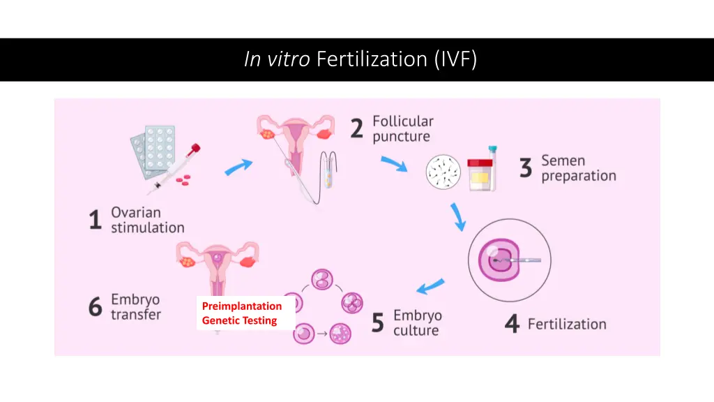 in vitro fertilization ivf