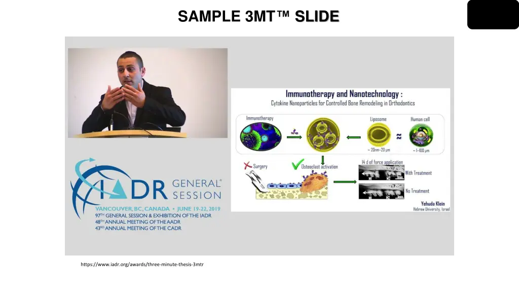 sample 3mt