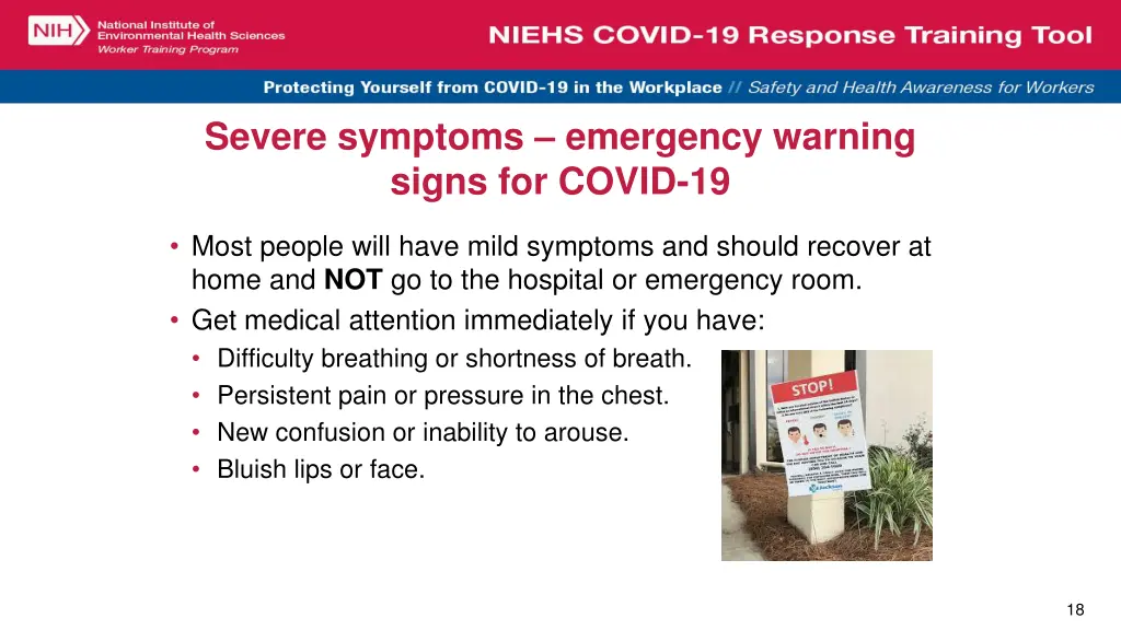 severe symptoms emergency warning signs for covid
