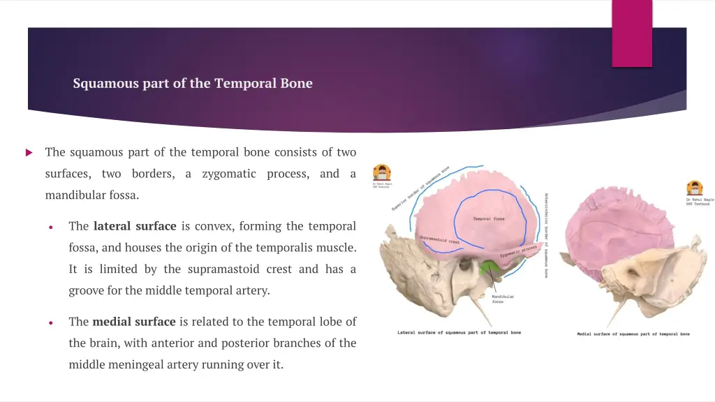 squamous part of the temporal bone 2