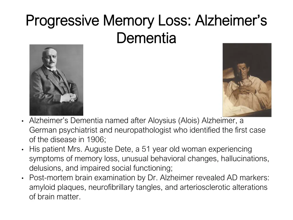 progressive memory loss alzheimer s progressive 1