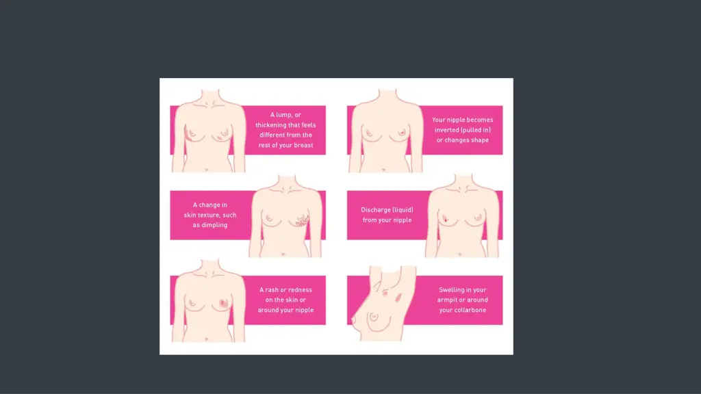 slide35