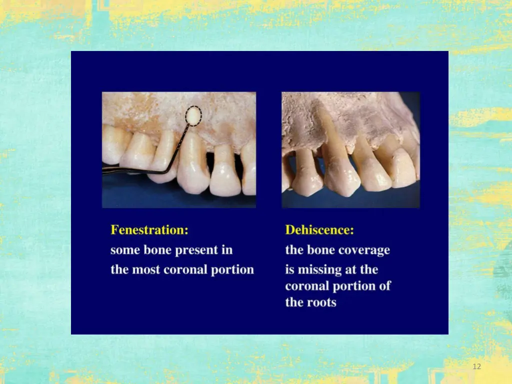 slide12