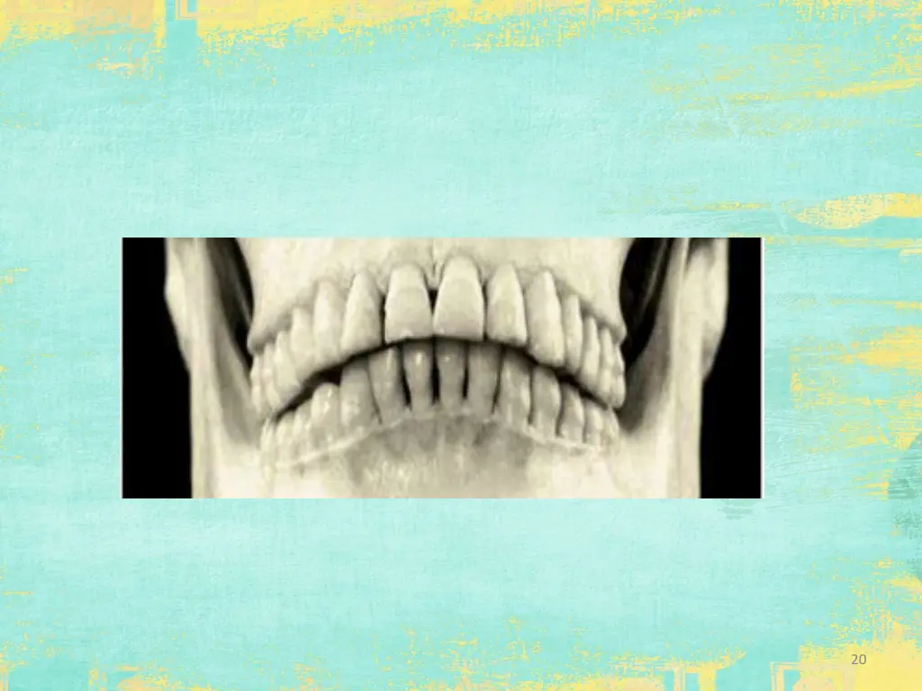 slide20